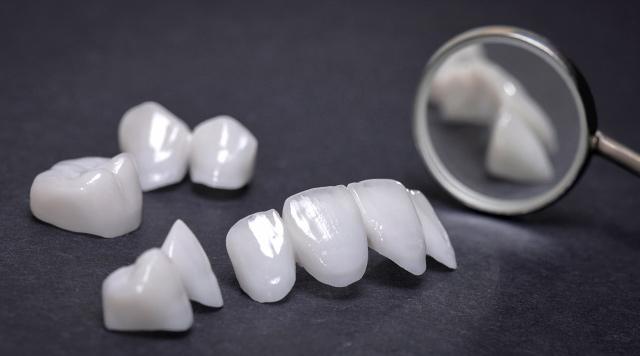 Why choose zirconia ceramics for dental crowns and bridges?