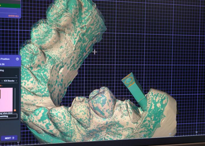 Kalmar Implant Dentistry 8